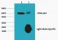 NFkB p65 Monoclonal Antibody(14H2)